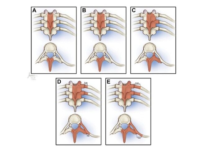 腰粗不一定是胖！这个体态问题正在影响你的
